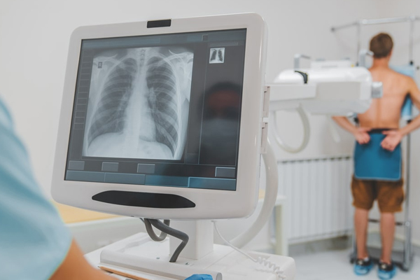 X-Ray Machine